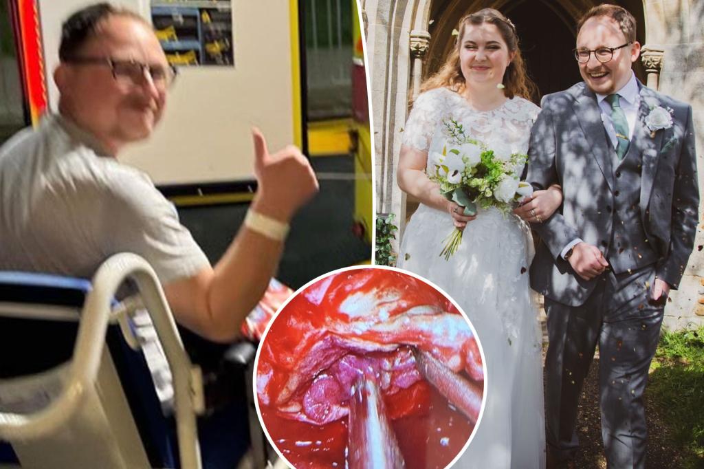 Groom misses wedding reception due to tumor mistaken for migraine